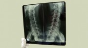 Welch Chiropractic Center
