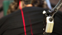Low Level Laser Therapy